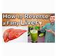 Natural Fatty Liver Detox